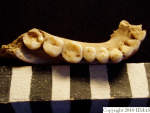 L_V20d5017 A16.175 R814 lR ta mandible dental cavity
